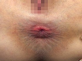 アナル大図鑑 37人のお尻の穴 これを見ればキミも肛門博士！　サンプル画像04